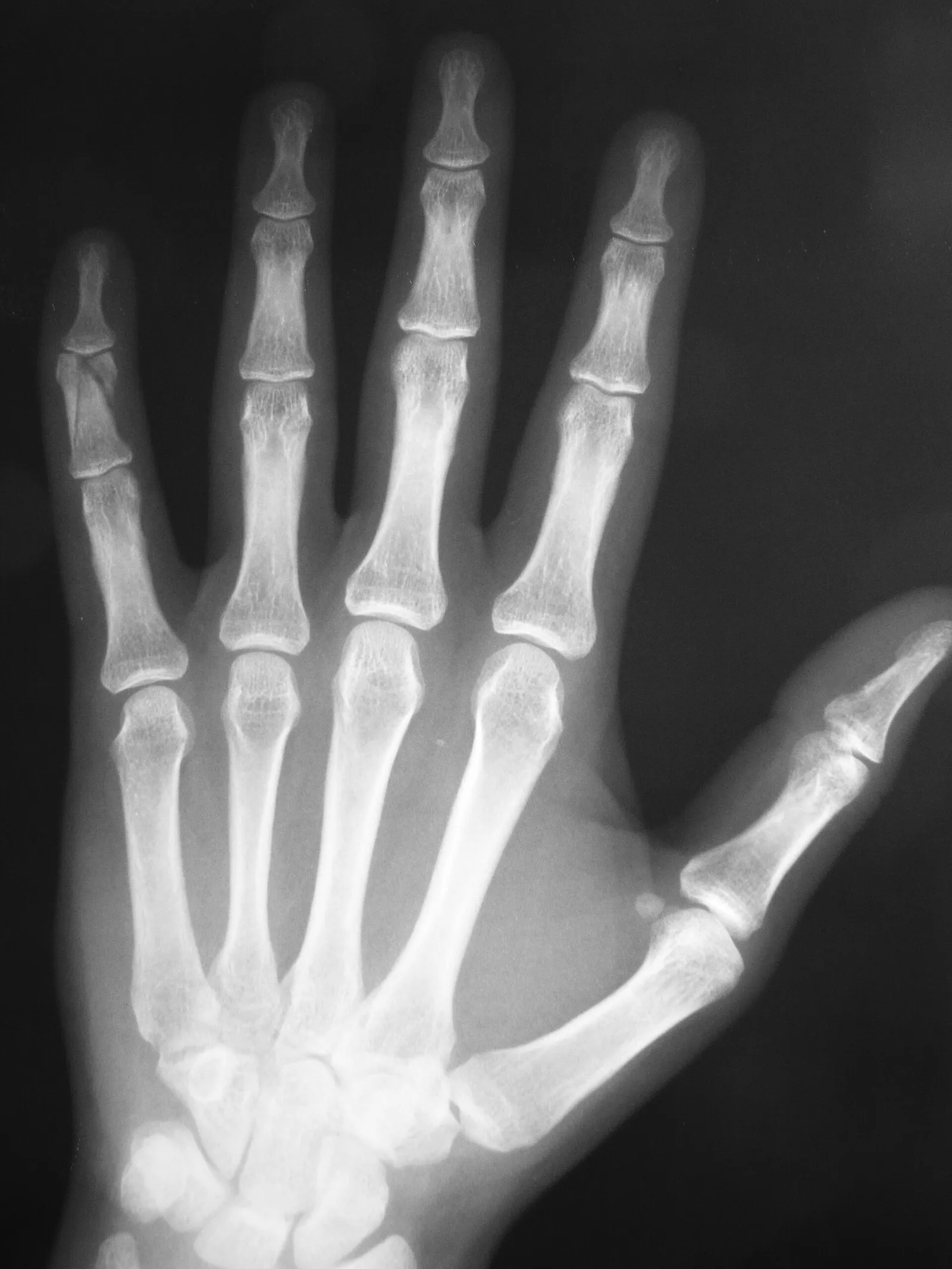 International Day of Radiology